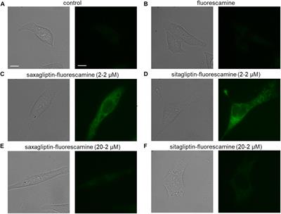 Saxagliptin but Not Sitagliptin Inhibits CaMKII and PKC via DPP9 Inhibition in Cardiomyocytes